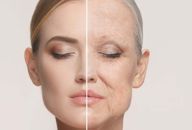 सुरकुत्या काढणे Skin Tightening, Lifting Wrinkle Removal.