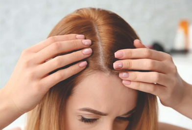 केस गळणे Hair Loss Management